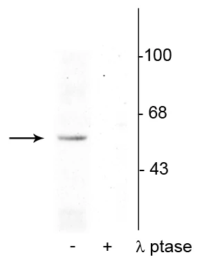 Anti-p53 (Ser392) Antibody