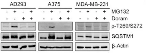 Anti-p62 (Thr269, Ser272) Antibody - Image 2