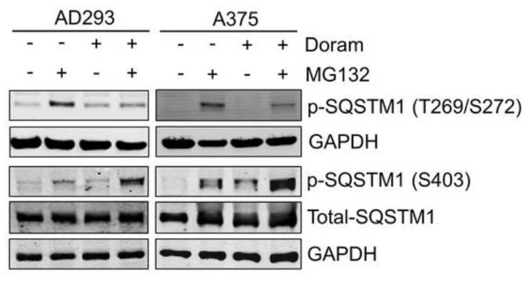Anti-p62 (Thr269, Ser272) Antibody - Image 3