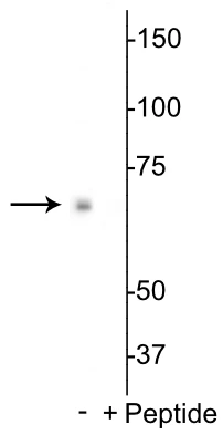 Anti-p70 S6 Kinase (Ser398) Antibody