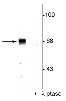 Anti-PAK-1,2,3 (Thr402) Antibody