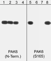 Anti-PAK6 (Ser-165), Phosphospecific Antibody