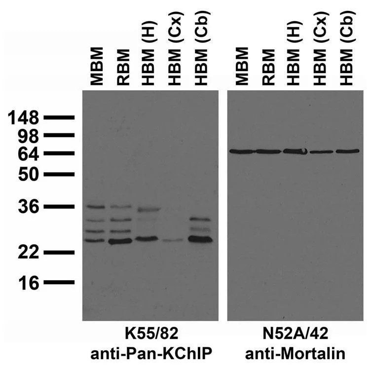 Anti-Pan-KChIP K+ Channel Antibody - Image 3