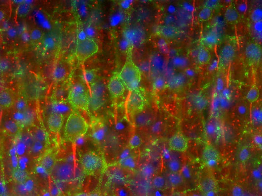 Anti-Pan-Nav1 Sodium Channel Antibody
