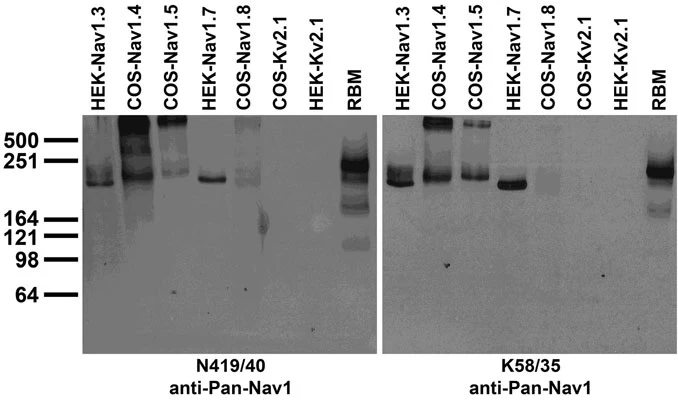 Anti-Pan-Nav1 Sodium Channel Antibody - Image 2