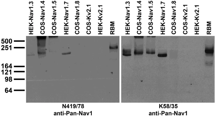 Anti-Pan-Nav1 Sodium Channel Antibody