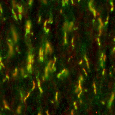 Anti-Pan-Neurofascin Antibody