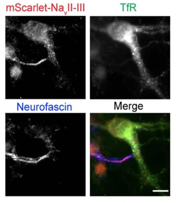 Anti-Pan-Neurofascin (Extracellular) Antibody - Image 4