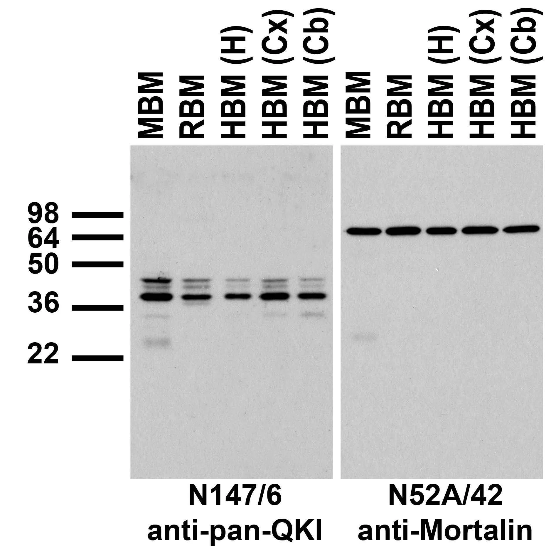 Anti-Pan-QKI Antibody
