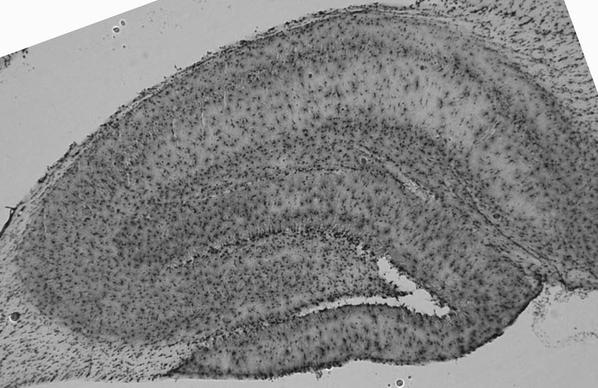 Anti-Pan-QKI Antibody - Image 2