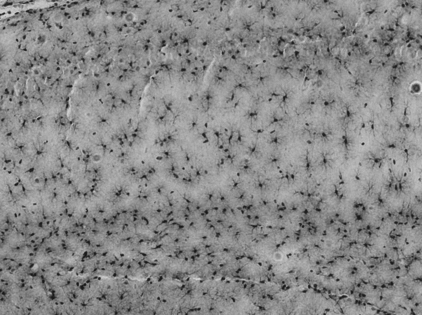 Anti-Pan-QKI Antibody - Image 3