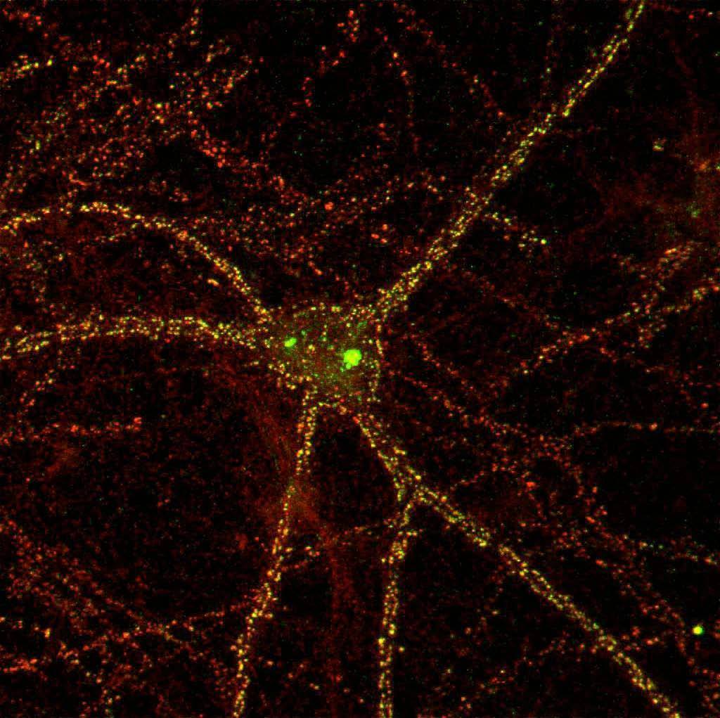 Anti-Pan-SAPAP Antibody - Image 3