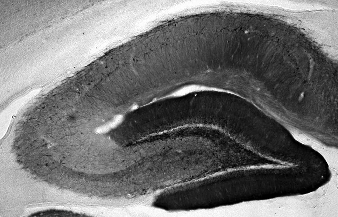 Anti-Pan-SAPAP Antibody - Image 4