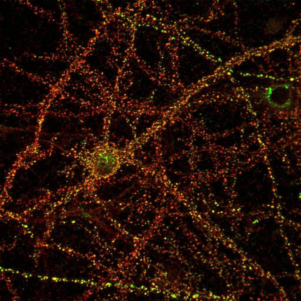 Anti-Pan-SAPAP Antibody - Image 7