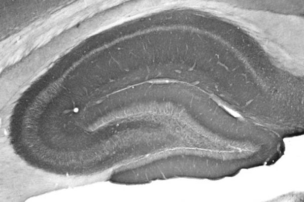Anti-Pan-Shank Antibody - Image 2