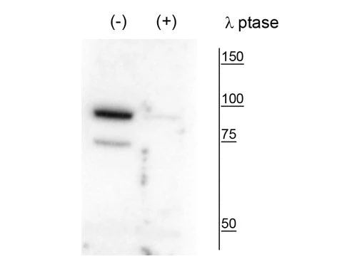 Anti-PanK4 (Thr63) Antibody