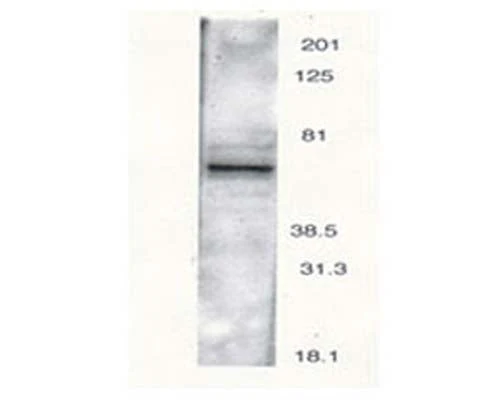 Anti-Parathyroid hormone 2 receptor (PTH2 receptor) Antibody