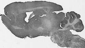 Anti-PARIS/ZNF746 Antibody