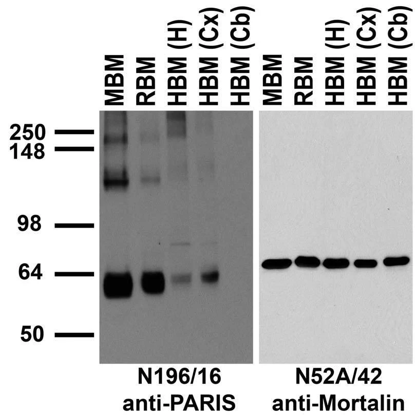 Anti-PARIS/ZNF746 Antibody - Image 4