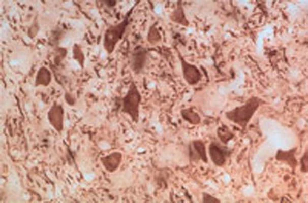 Anti-Parkinson disease protein 2 (Parkin) Antibody