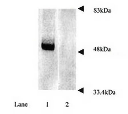 Anti-Parkinson disease protein 2 (Parkin) Antibody - Image 2