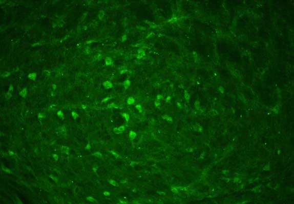 Anti-Parkinson disease protein 2 (Parkin) Antibody