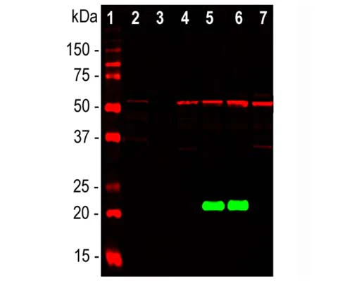 Anti-Parkinson disease protein 7 (PARK7) Antibody - Image 3