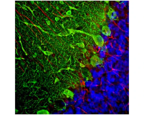 Anti-Parvalbumin Antibody - Image 2