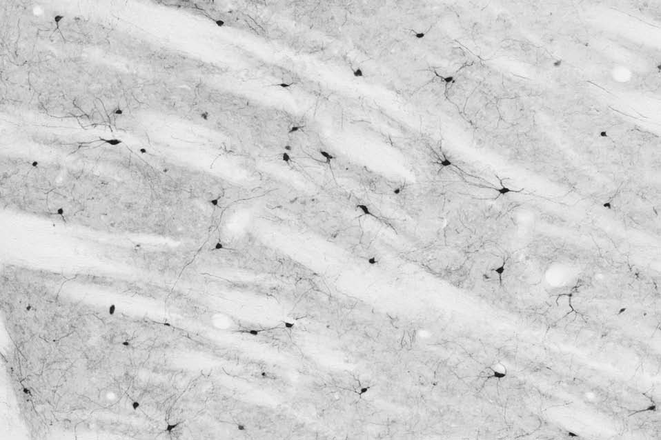 Anti-Parvalbumin Antibody - Image 2