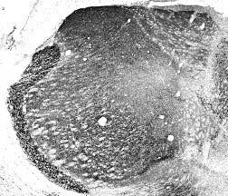 Anti-Parvalbumin Antibody - Image 3