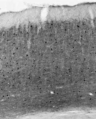 Anti-Parvalbumin Antibody