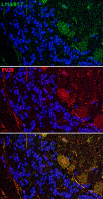 Anti-Parvalbumin Antibody - Image 3
