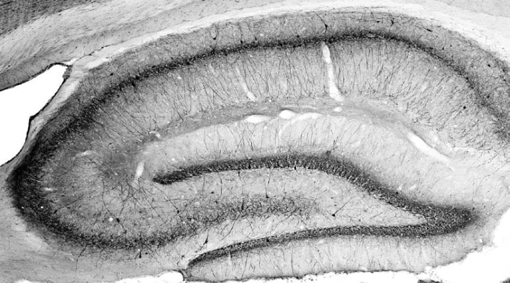 Anti-Parvalbumin Antibody - Image 4