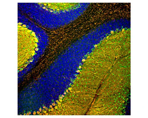 Anti-Parvalbumin Antibody - Image 2