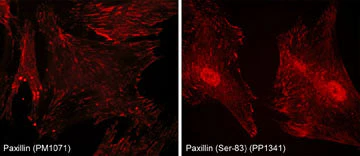 Anti-Paxillin (Ser-83), Phosphospecific Antibody - Image 2