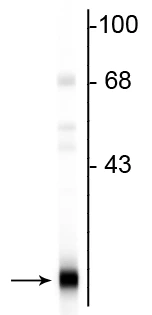 Anti-PEBP (phosphatidylethanolamie binding protein) Antibody