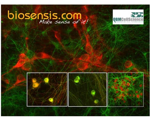 Anti-Peripherin Antibody