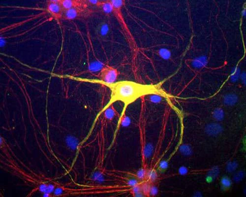 Anti-Peripherin Antibody - Image 2
