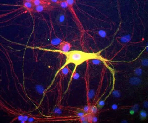 Anti-Peripherin Antibody