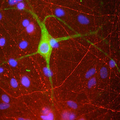 Anti-Peripherin Antibody - Image 2