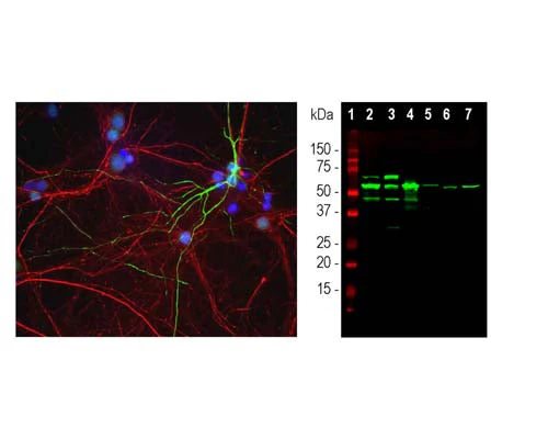 Anti-Peripherin Antibody - Image 2