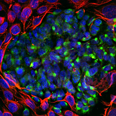 Anti-Peripherin Antibody
