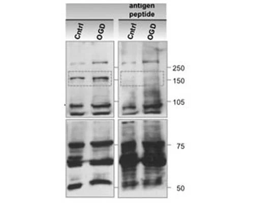 Anti-PERK (phosphorylated and non phosphorylated) Antibody