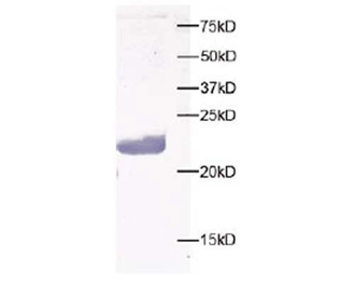 Anti-Peroxiredoxin-5 Antibody