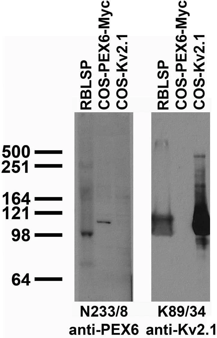 Anti-PEX6 Antibody