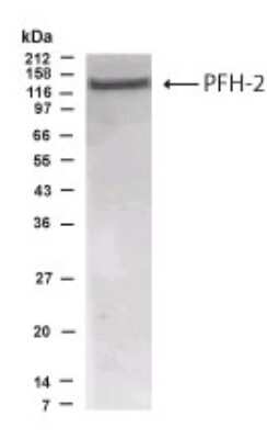 Anti-PHF2 Antibody