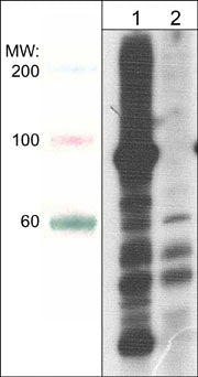 Anti-Phosphoserine/threonine Antibody