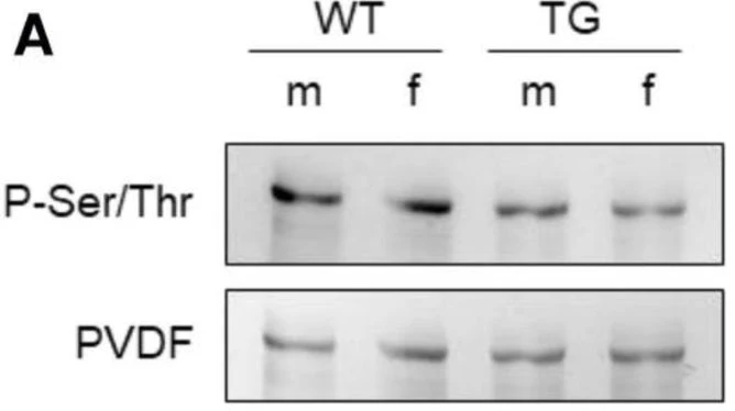 Anti-Phosphoserine/threonine Antibody - Image 3
