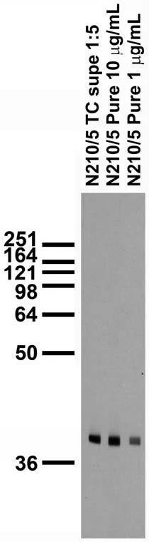 Anti-PhyH/PAHX Antibody