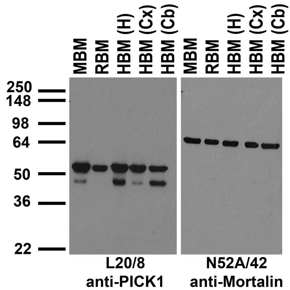 Anti-PICK1 Antibody - Image 2